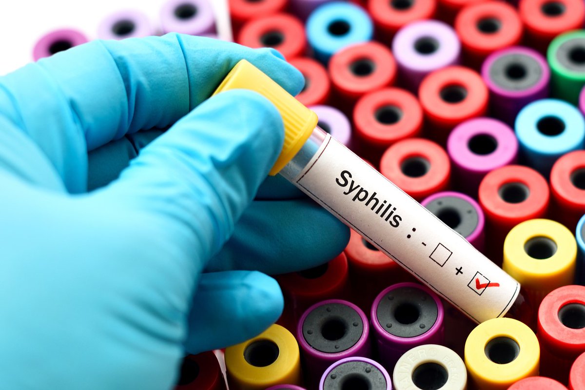 Sexually transmitted infections continue to climb in US

Gonorrhea and chlamydia cases increased by 4% in 2021, while syphilis cases rose by 32% #STI

ow.ly/WjBz50NGtP0