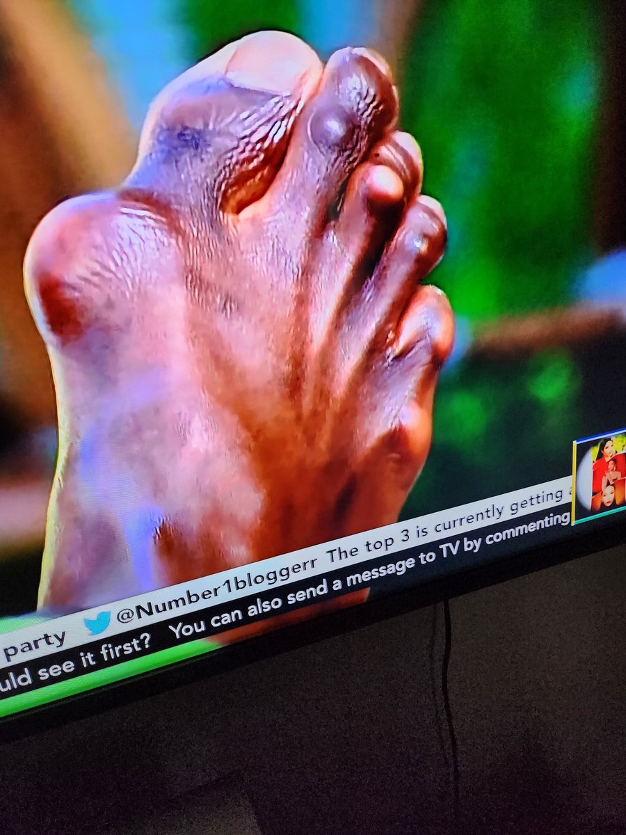 KForce this crucked toe(though edited) deserves 200 retweets and 50  comments Do it for the ugly toe 🌚 KANAGA JNR X KFORCE WOO BRANDS FOR  KANAGA JNR PROJECT 24 CHALLENGE #KanagaJnr || #KForce