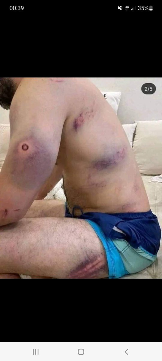 The brutality of the Ministry of Defense. Dictator Aliyev. Those who were tortured by the order of Zakir Hasanov. This is how they torture people.