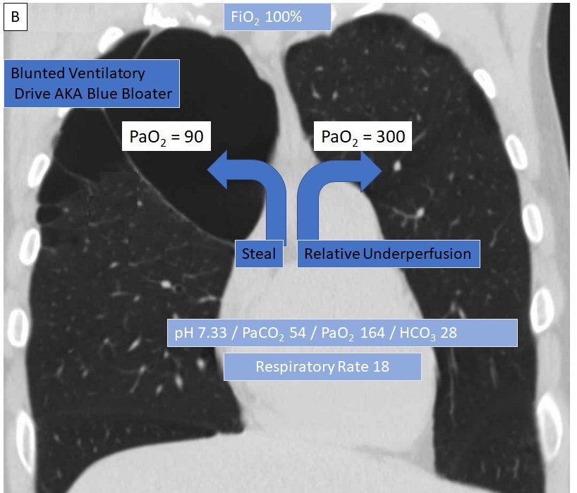 Hans Huitink on Twitter: