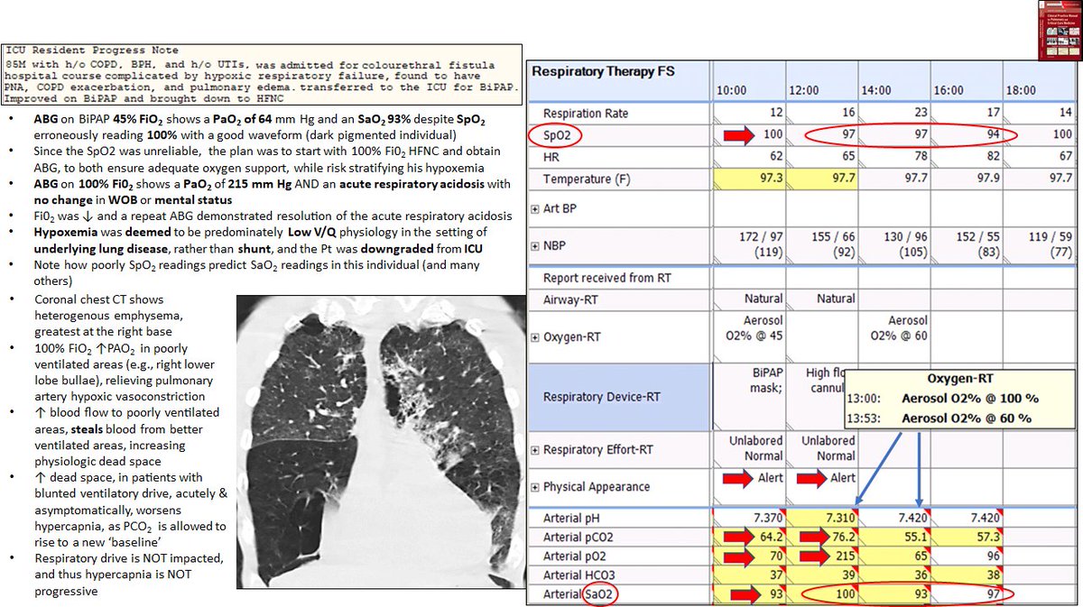 Hans Huitink on Twitter: