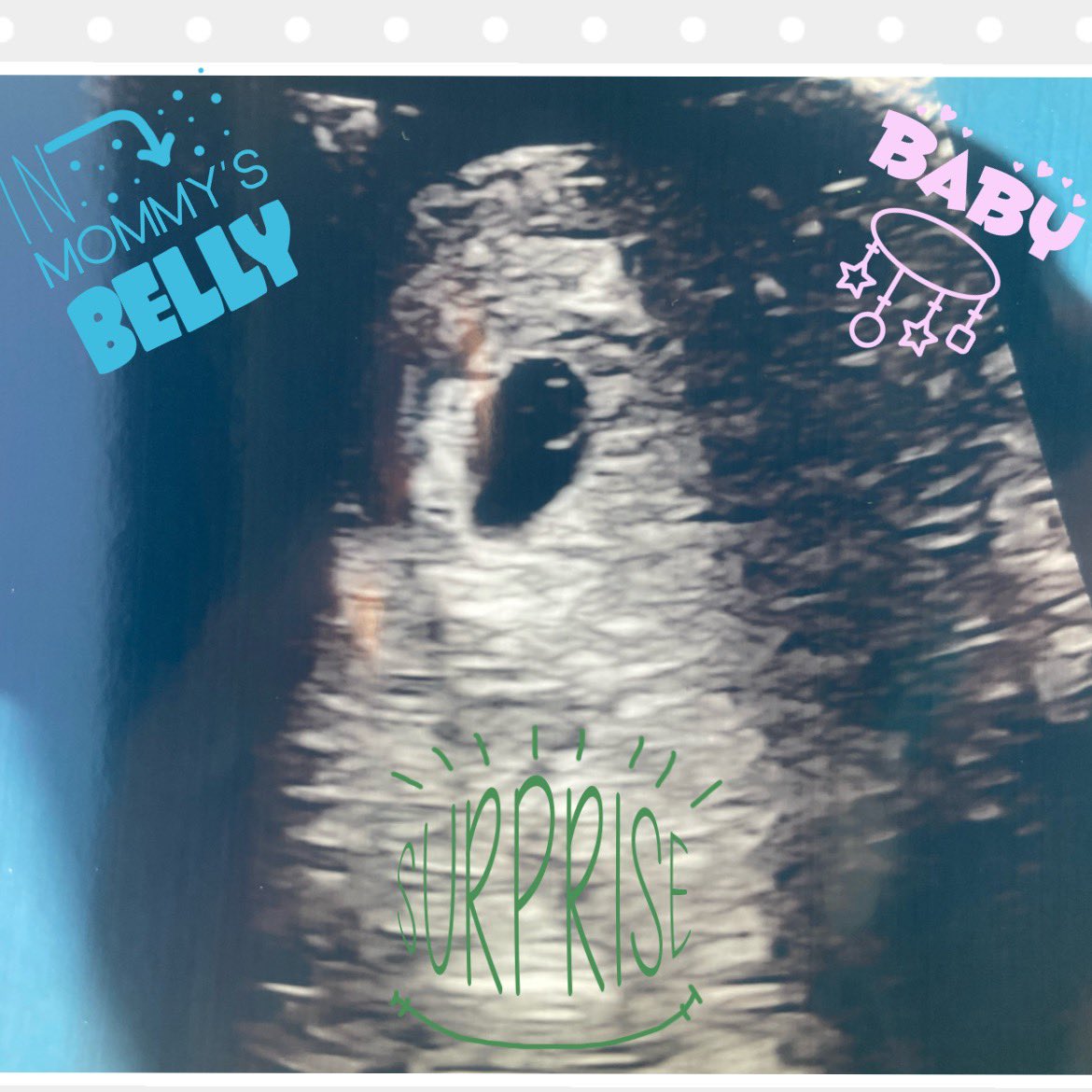 Adas becoming a big sister 🩵!