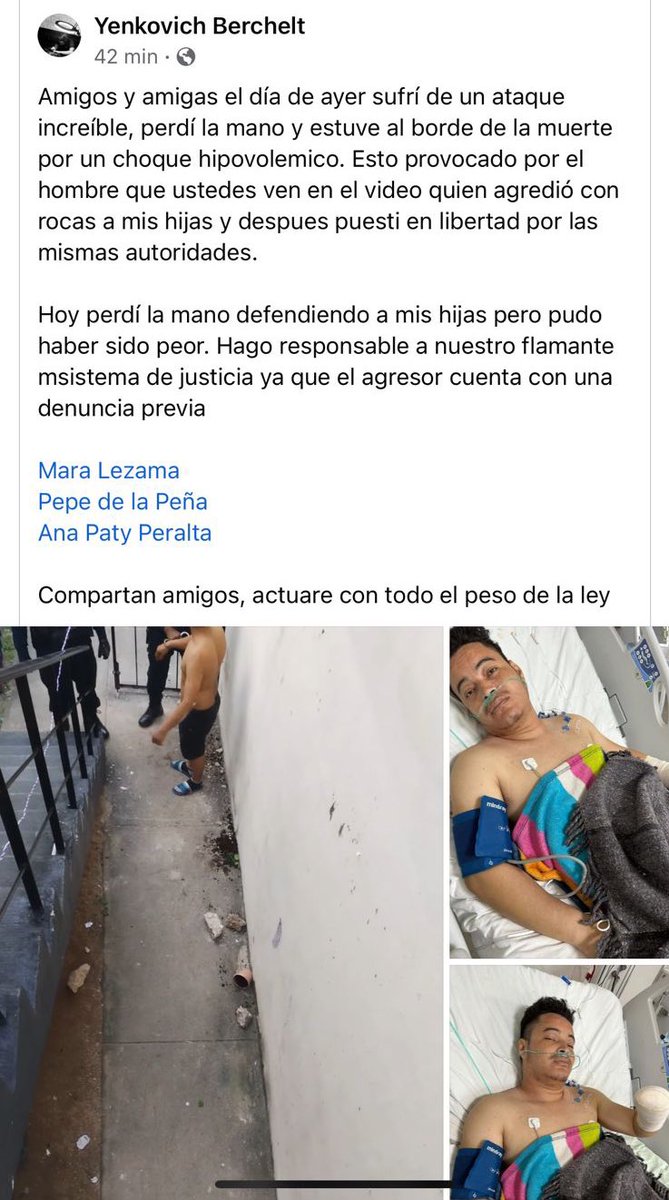 VigiaCiudadano7's tweet photo. Que cabrona situación, pleito entre vecinos y uno fue detenido por la @PoliciadeCancun, posteriormente liberado por la @FGEQuintanaRoo para regresar y mutilarle la mano a quien lo había denunciado.
@MaraLezama @anapatyp @GobQuintanaRoo @FGRMexico https://t.co/V9uGxlpOaH