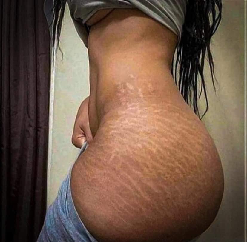 stretch marks are so sexy… do you have any stretch marks?