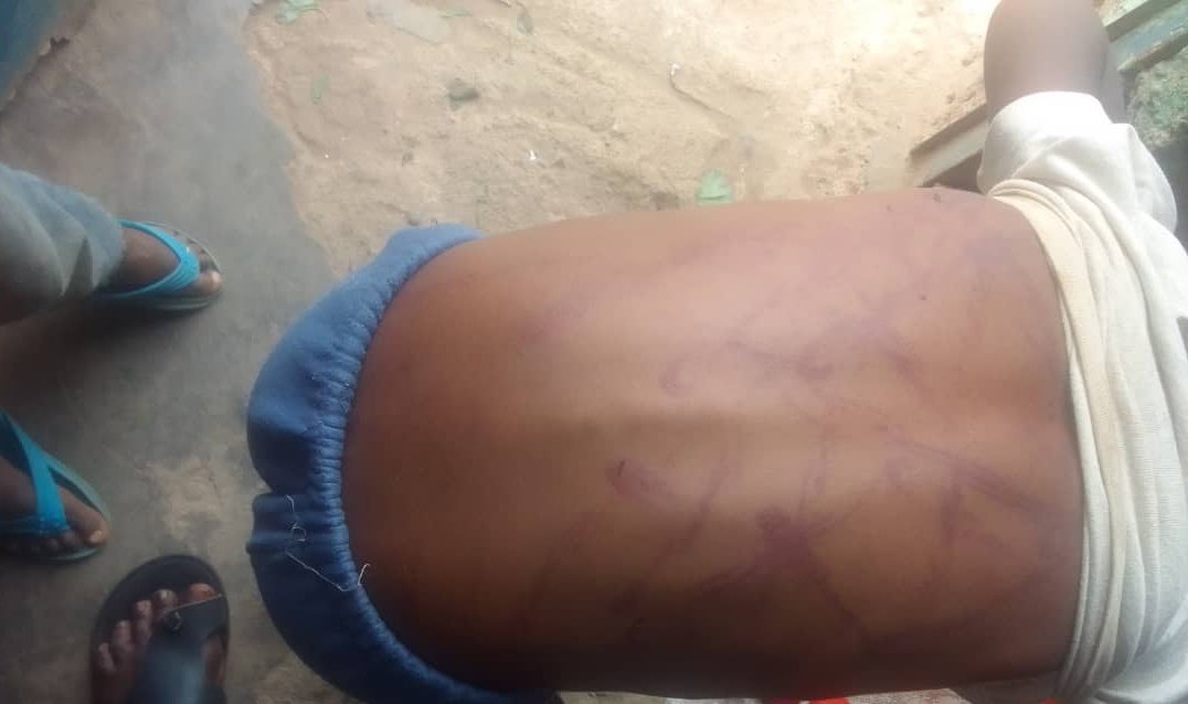 mfabrouce's tweet image. Dear @Nyarugenge and @RIB_Rw mwaramutse, 
Amafoto akurikira agaragaza umwana wakubiswe na mukase ,ni m'Umurenge wa #Muhima akagari  #Kabeza umudugudu ni #Ikaze

Mushobora kubikurikirana.