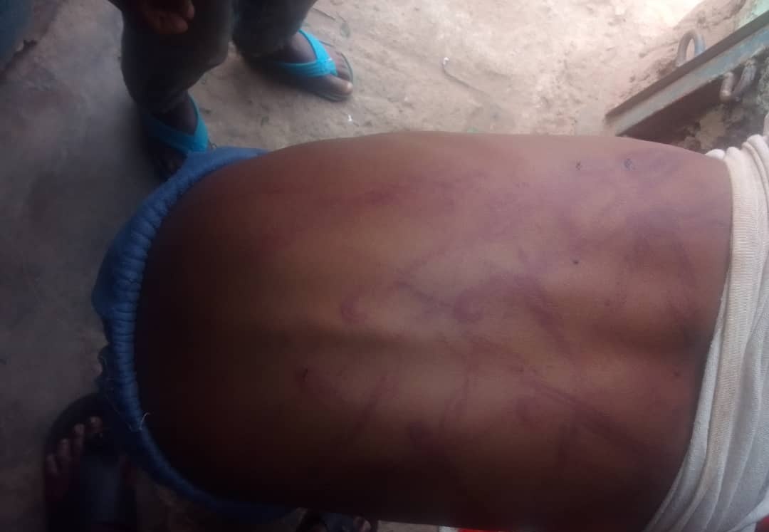 mfabrouce's tweet image. Dear @Nyarugenge and @RIB_Rw mwaramutse, 
Amafoto akurikira agaragaza umwana wakubiswe na mukase ,ni m'Umurenge wa #Muhima akagari  #Kabeza umudugudu ni #Ikaze

Mushobora kubikurikirana.