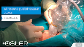 oslertech's tweet photo. Ultrasound guided vascular access

https://t.co/B9y28YQ0ME

#medtwitter #meded #FOAMed #FOAMcc #FOAMpocus #POCUS #medstudents #medschool #tipsfornewdocs #juniordoctors #juniordocs #MedStudentTwitter #medstudents https://t.co/FhuSHvLZve