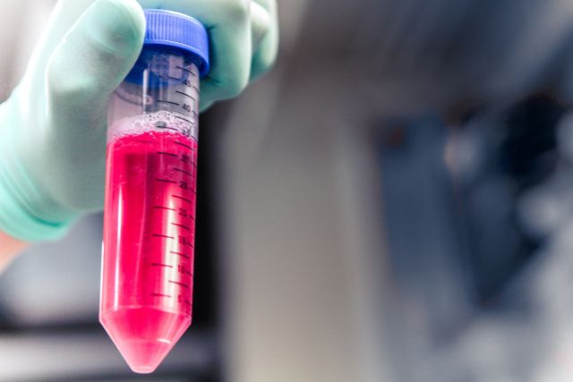 microbiozindia's tweet image. What to Consider Prior to Purchasing Centrifuge Tubes 
microbiozindia.com/what-to-consid… 
#centrifugetubes #biopharma #pharma