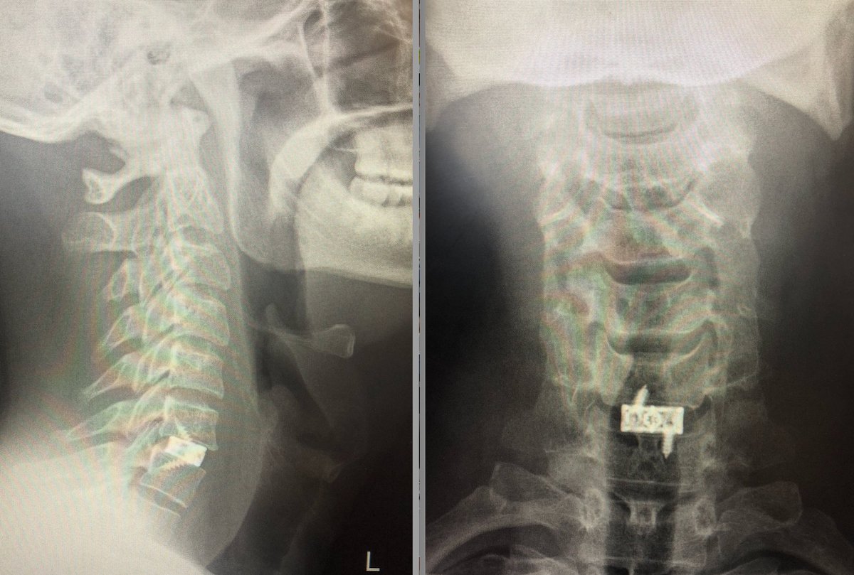 Craig Broome tweet media