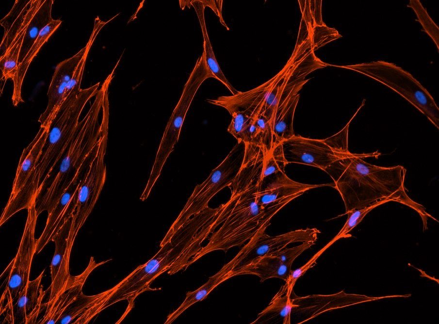 Mei ElGindi (@elgindimei) on Twitter photo My first steps towards stromal immunology…<a href="/jsapudom/">Jiranuwat (Bas) Sapudom</a> <a href="/JeremyTeoLab/">Jeremy Teo</a> #stromalcells #immunology My first steps towards stromal immunology…<a href="/jsapudom/">Jiranuwat (Bas) Sapudom</a> <a href="/JeremyTeoLab/">Jeremy Teo</a> #stromalcells #immunology
