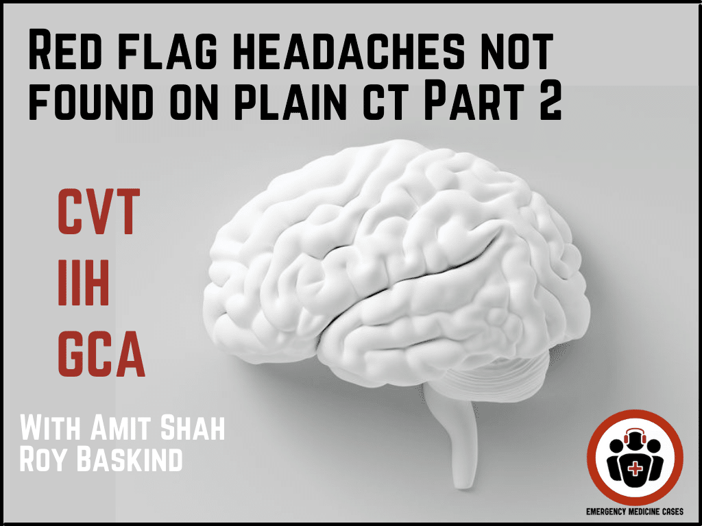 EMCases's tweet photo. 🚩RED FLAG HEADACHES NOT FOUND ON CT🚩

🧠When do you order a CT venogram in a patient w/unexplained headache?
🩸What's the value of a D-dimer to screen for Cerebral Venous Thrombosis (CVT)? 

These questions answered &amp; more here: https://t.co/deXh49qrCr 

#FOAMed #MedTwitter https://t.co/1xMZRTf2js