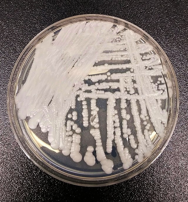 It's time for #MicrobeoftheMonth! Who am I? 

1) I'm a fun guy.
2) I'm often resistant to drugs used to combat me.
3) I'm becoming more common across the world.

Think you know? Comment below!