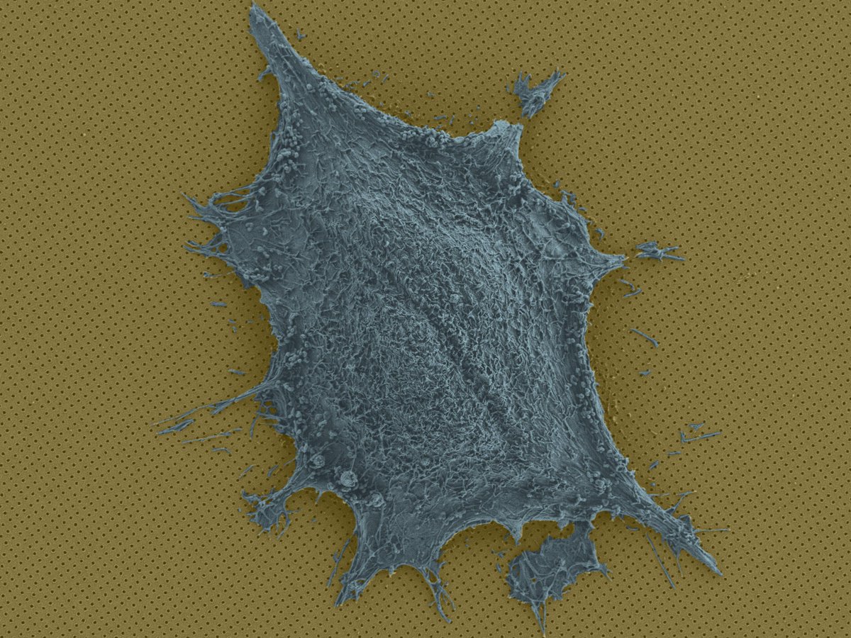 nanotrac's tweet photo. Nanoplasmonic imaging reveals real-time protein secretion https://t.co/wy1OsRYNc3 | @physorg_com #NanoplasmonicImaging #RealTime #ProteinSecretion https://t.co/RRLX6tQysD