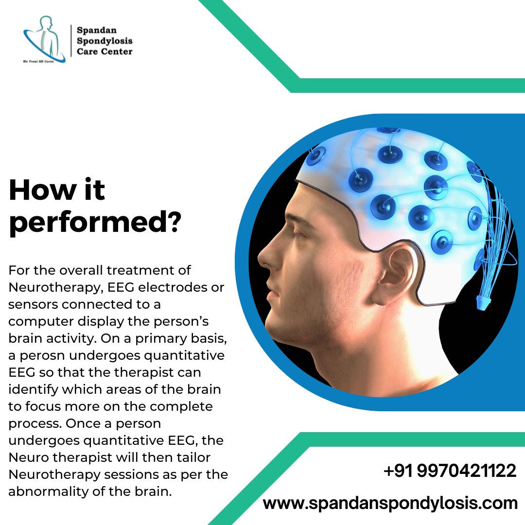SSpondylosis's tweet photo. Find out more information about Neurotherapy: https://t.co/t8GwnqTHvq
Contact us: +91 9970421122
--
#spineproblem #spineproblems #spine #backproblem #neurotherapy #spondylolysis #lumbar #lumbarspine #lumbarspondylosis #cervical #sciatica https://t.co/aQZEq4ikdR