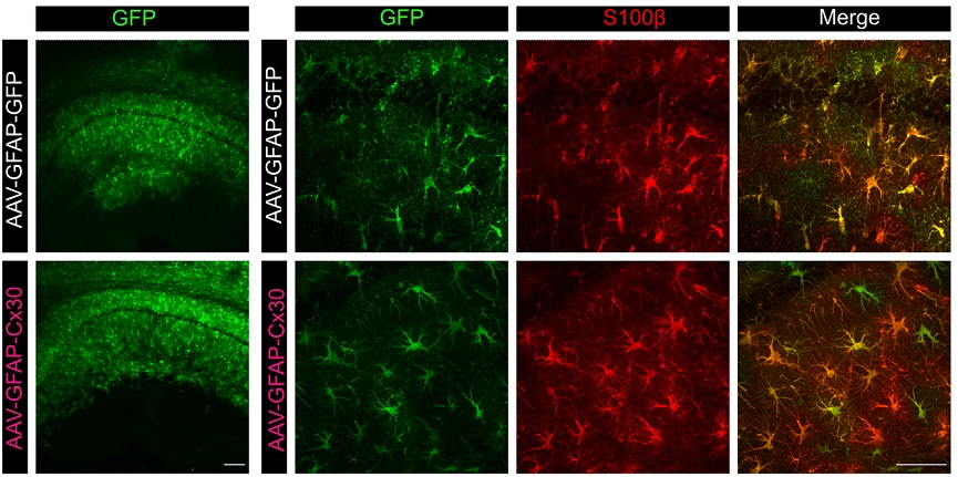 PLOSBiology's tweet photo. Upregulation of #connexin 30 in #astrocytes increases connectivity of #astroglial networks, but decreases synaptic transmission, altering #SynapticPlasticity &amp; learning processes @EleonoreHardy_ @NathalieRouach @RancillacA &amp;co #PLOSBiology https://t.co/DQ0yMssIop https://t.co/POExKshmjo