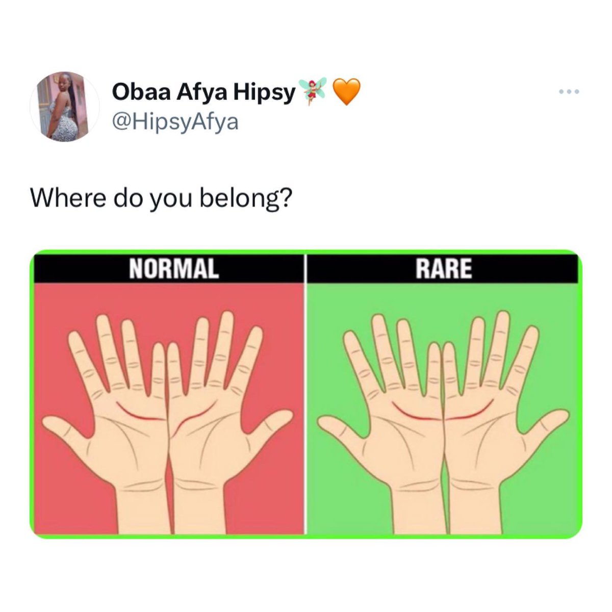 PulseGhana's tweet photo. Are you normal or rare?🤔

#TweetPostOnPulse https://t.co/bfHU5ylSSW