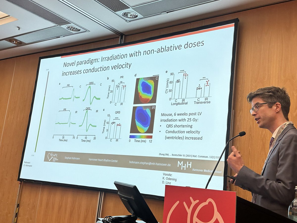 DavidDuncker's tweet photo. #DGKJahrestagung 

@SHohmannMD on mechanisms underlying stereotactic radioablation for VT

💡favourable clinical results
💡“histological scar homogenization“
❓40Gy leads to conduction slowing
❓radiation w/ non-ablative doses increases conduction velocity ⏩️ VT abolition

#HannoverHeartRhythmCenter