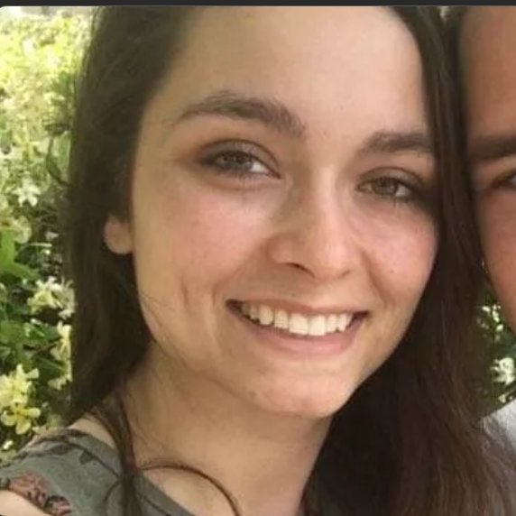 MinoShah's tweet image. Vicki died of #ALS after being diagnosed at 28 years old.

As the incidence of 100% FATAL #ALS keeps increasing &amp;amp; younger people are afflicted, we NEED #Congress to help END the CRUEL @FDACBER regulatory RIGIDITY for ALS.

Tell @DrCaliff_FDA to give #Nurown accelerated approval…