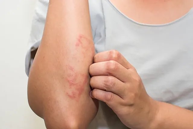 SnapMedical's tweet photo. 5 Myths every person should understand when it comes to anaphylactic treatment.

THREAD: https://t.co/hRaCmmfiVb