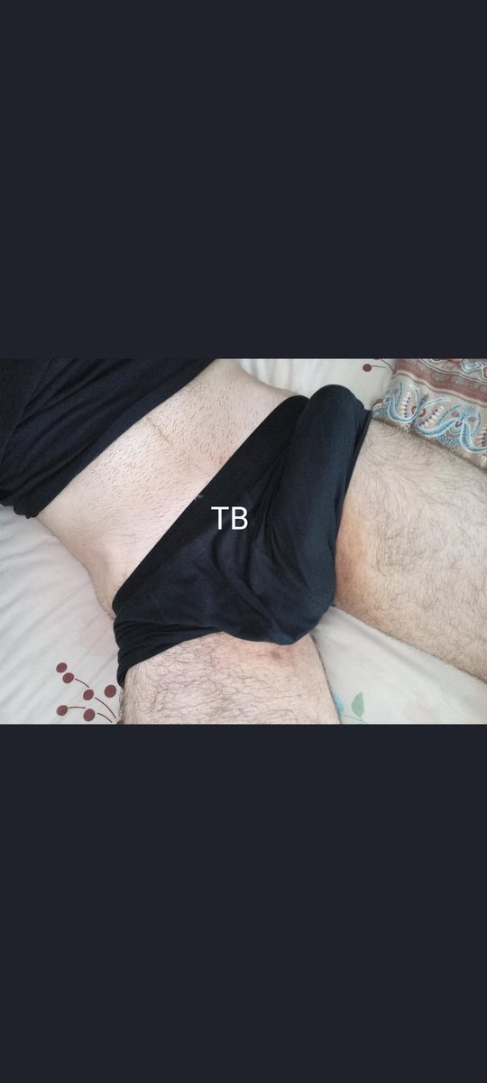 TurkiyeBulge's tweet photo. Açık hâlini merak ediyorsanız bol bol rt ve beğeni yapalım 😍 https://t.co/BRZhgyp4nd