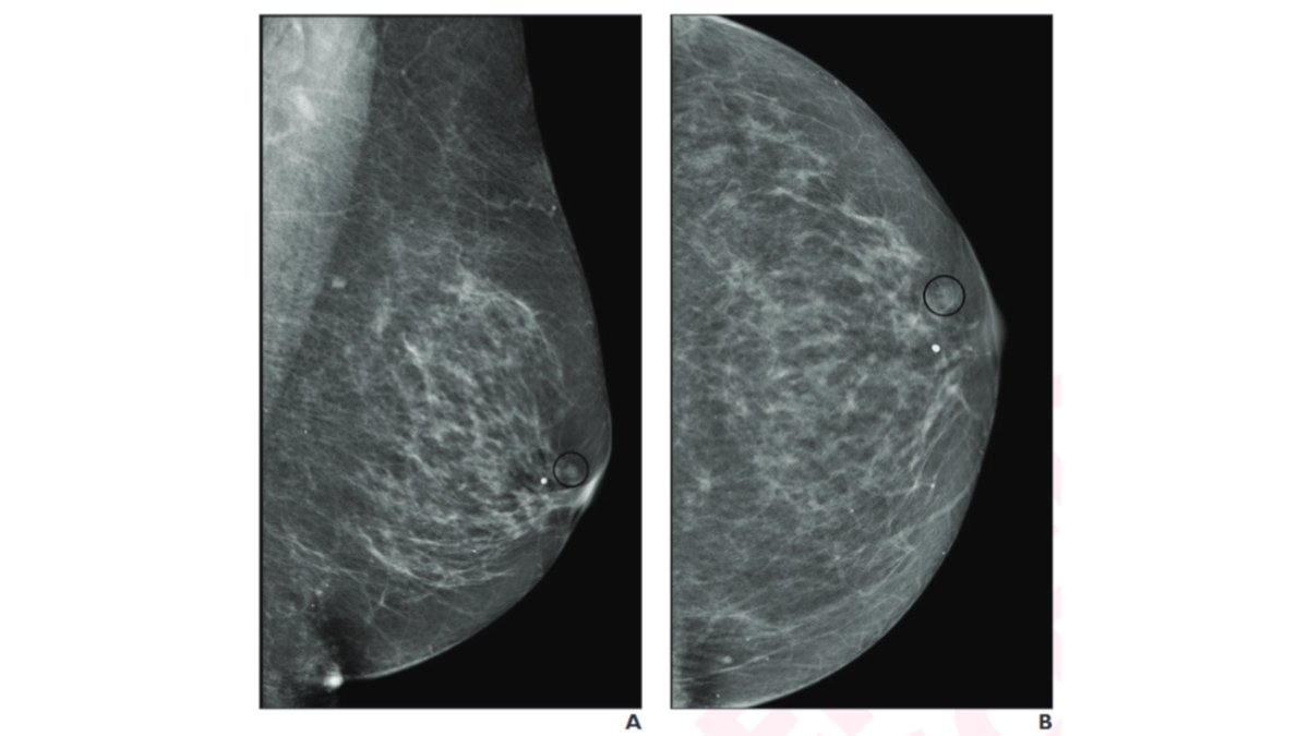 Andrew Rosenkrantz tweet media