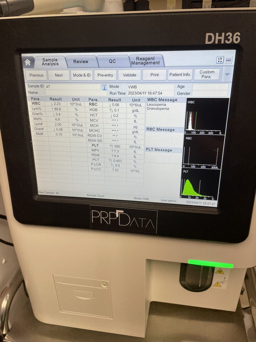 Orgullosos de ser el primer servicio de un hospital público español en introducir el sistema PRPData para mejorar la cuantificación y el manejo de tratamientos ortobiológicos.

Gracias a <a href="/hujuanramon/">HU Juan Ramón Jiménez</a> y TODOBioConsulting por hacerlo posible.
