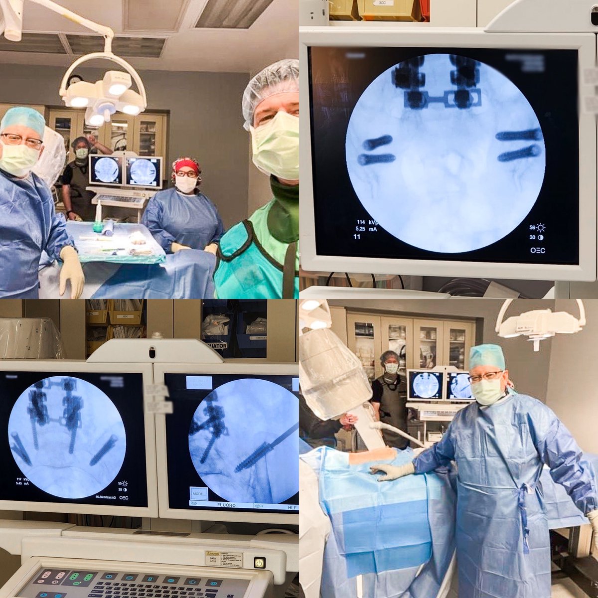 CornerLoc's tweet photo. Packed day of #TransLoc3D™ cases! Dr. Badawy completed 3 cases - two of which were patients who received 100% pain relief after treating one SI joint and were ready for relief of the other SI joint pain. To learn more, visit https://t.co/D1kvncVFLY. https://t.co/Rzbkp4N06n