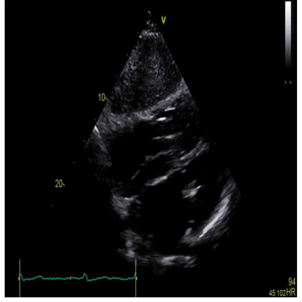 Italian Cardiologists Of Tomorrow tweet media