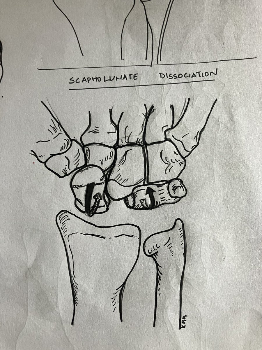 Dr Kannan K Kumar (@plexusorthoexam) on Twitter photo 