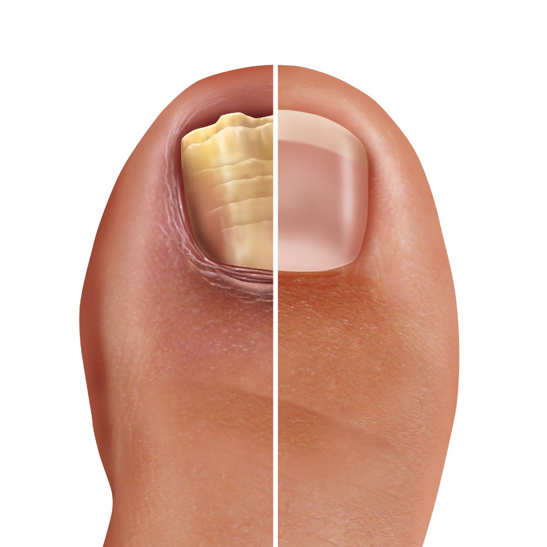 FootDoctorsNJ tweet picture