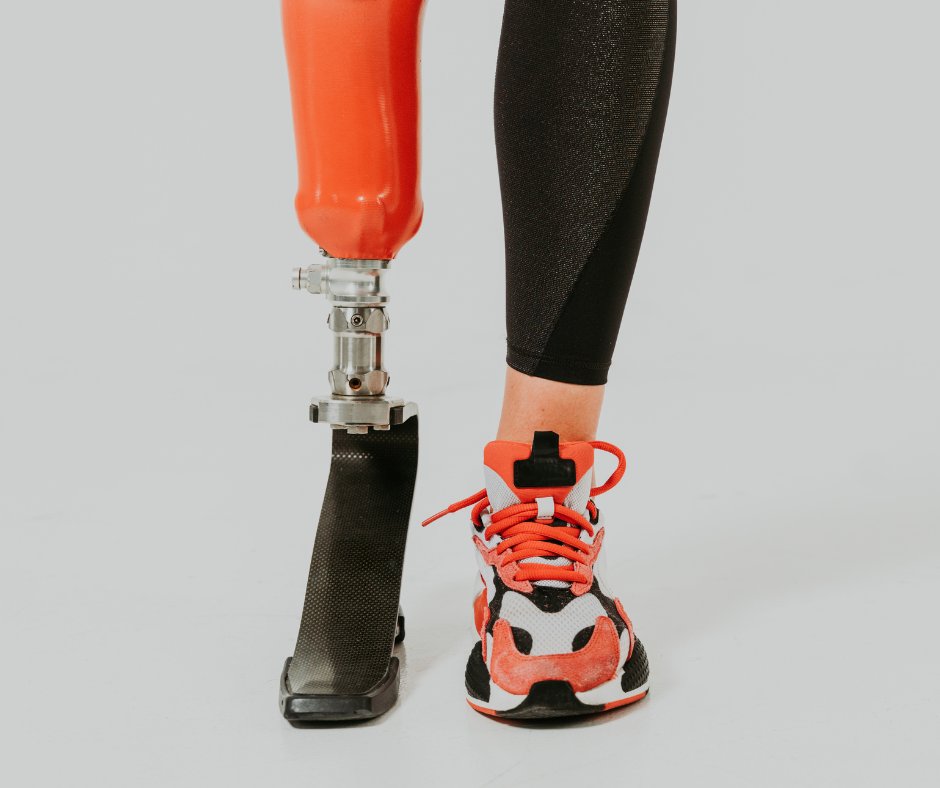 RossSCohenDPM's tweet photo. The development of serious foot ulcers and wounds is a leading cause of amputations among diabetics. Luckily there are things you can do to prevent this. Get some limb preservation tips and more information on amputations in our latest blog: https://t.co/GUo6sIQFlz https://t.co/bytMorTMdA