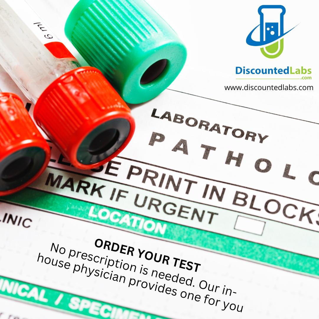 High costs should never prevent anyone from getting the care they need. That's why we offer affordable #bloodtesting options at #DiscountedLabs.

Our prices are frequently less than people's #insurance co-pays for lab testing, and no doctor's appointment is required.