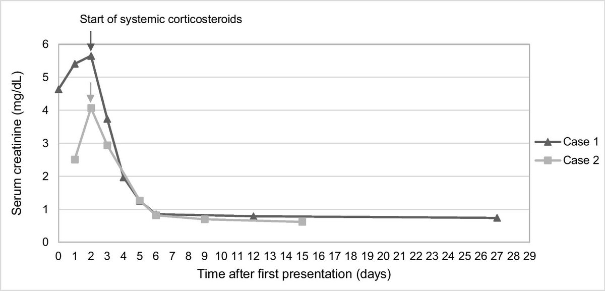 Ped_Neph's tweet photo. The role of glucocorticoids in the management of acute tubulointerstitial nephritis (ATIN) triggered by infectious agents is unclear. Read this Brief Report of ATIN caused by leptospirosis in a 12-yr-old boy &amp; hantavirus in a 10-yr-old girl.
https://t.co/gcBdsboCQg https://t.co/lFK2gjCU6G