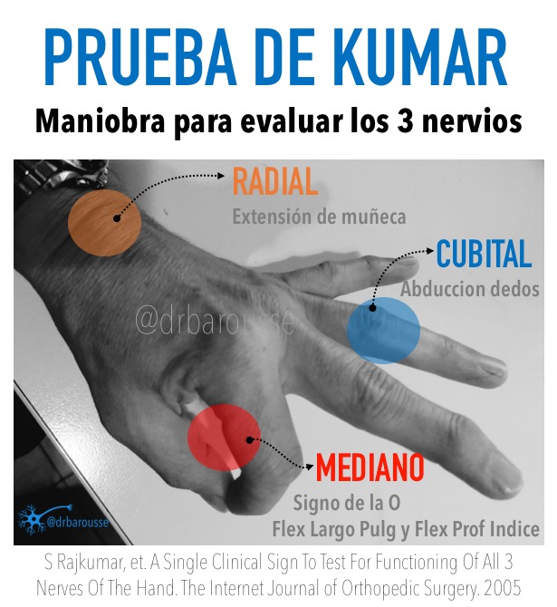 drbarousse's tweet image. difficult things can be easy #nerve #brachialplexus