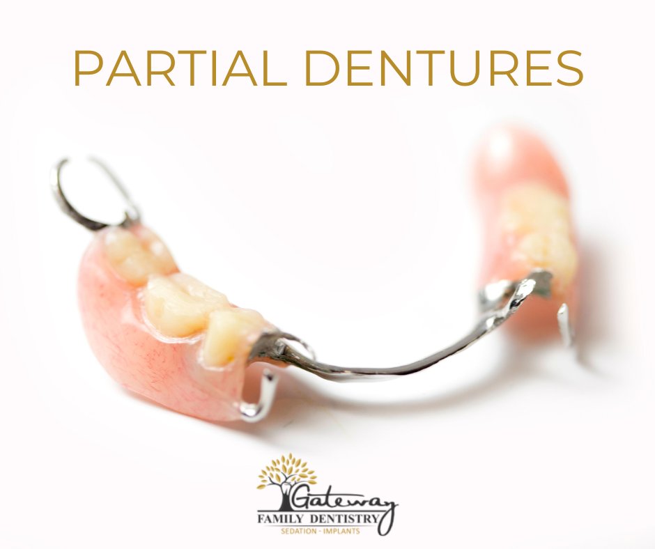 GFamDentistry's tweet photo. Partial dentures are used when there are some missing teeth. They are used when there are a few teeth missing teeth, and the remaining ones might be in good shape. 

Find out more about partial dentures: https://t.co/U1kUXyAQDP https://t.co/OorP7KxxMb