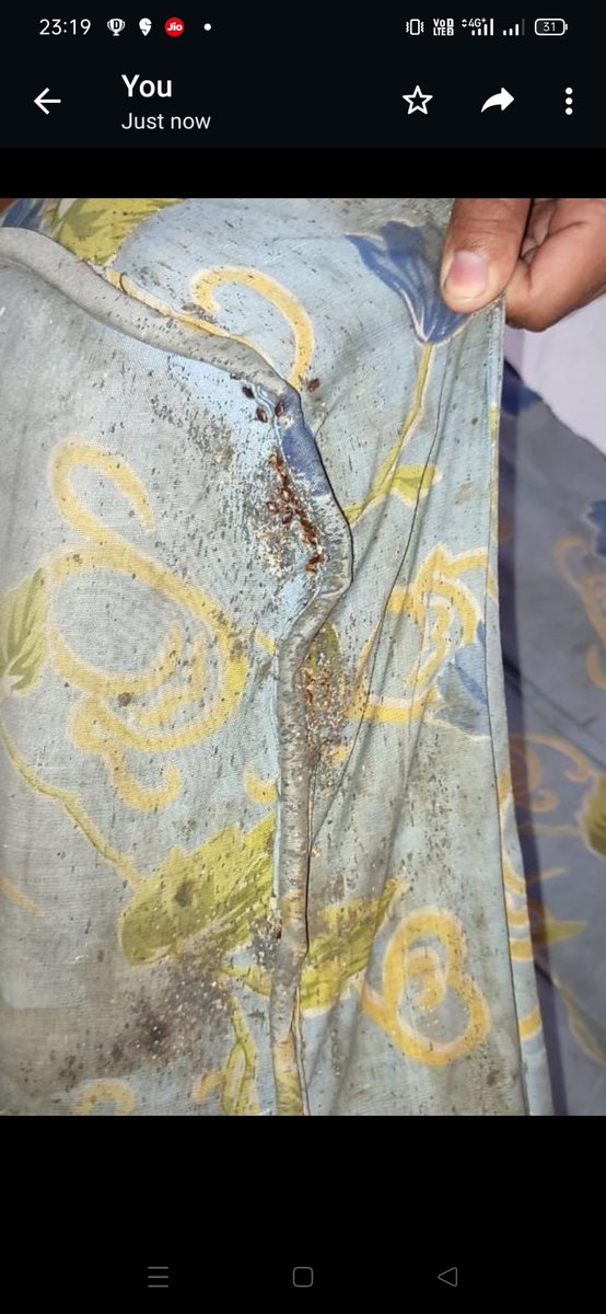 laxman8981's tweet photo. What a horrible experience!! In the retiring room and dormitory at Dhanbad railway station (ECR). If you book it you will  definitely spend a sleepless night due to bed bugs. This is the condition of IR @ECRlyHJP  @AshwiniVaishnaw 
@RailMinIndia https://t.co/vOEHIeJcLQ