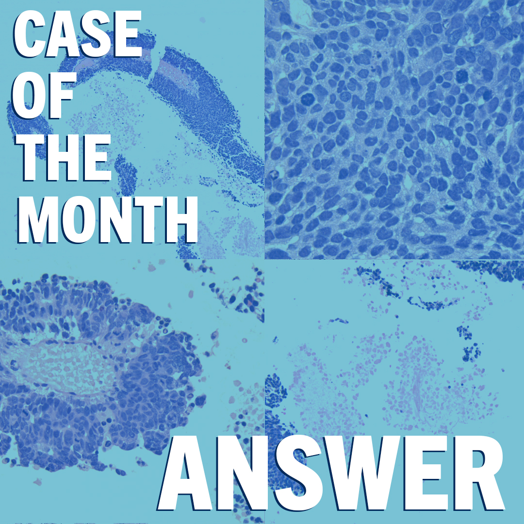 Did you participate in our March Case of the Month? If you did, we have the answer! ⬇️

🔗Check out the full case of the month and the answer and stay tuned for our next case of the month! ow.ly/RBjm50NH6m9

#uoft #uoftlmp #uoftmedicine #temertymed #caseofthemonth