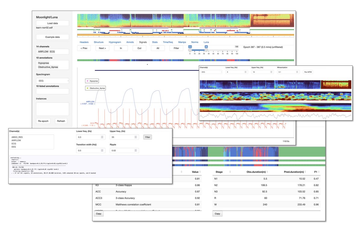 smpzzz's tweet photo. Open-source sleep signal analysis - a new Luna release!  Lots of new features including an interactive viewer (Moonlight, below), some new vignettes and a new stager, Dockerized versions, etc.  Details: https://t.co/Otw1OiYCV6   #NSRR #SleepData #Sleep #EEG @SleepDataNSRR https://t.co/FCGq3k90Gi