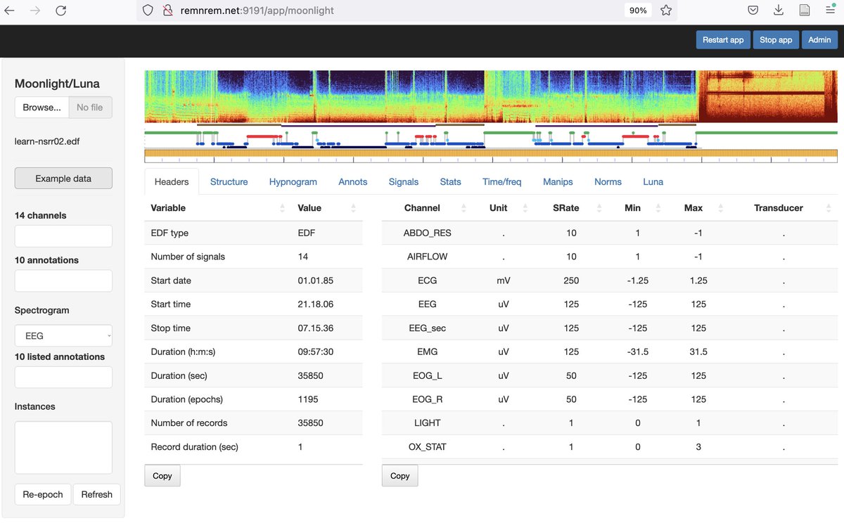 smpzzz's tweet photo. @SleepDataNSRR Free Moonlight demo hosted here: https://t.co/hs4hiprCY7
(click "Example data" on the left panel to load up a test EDF). https://t.co/LZT7uae2c1