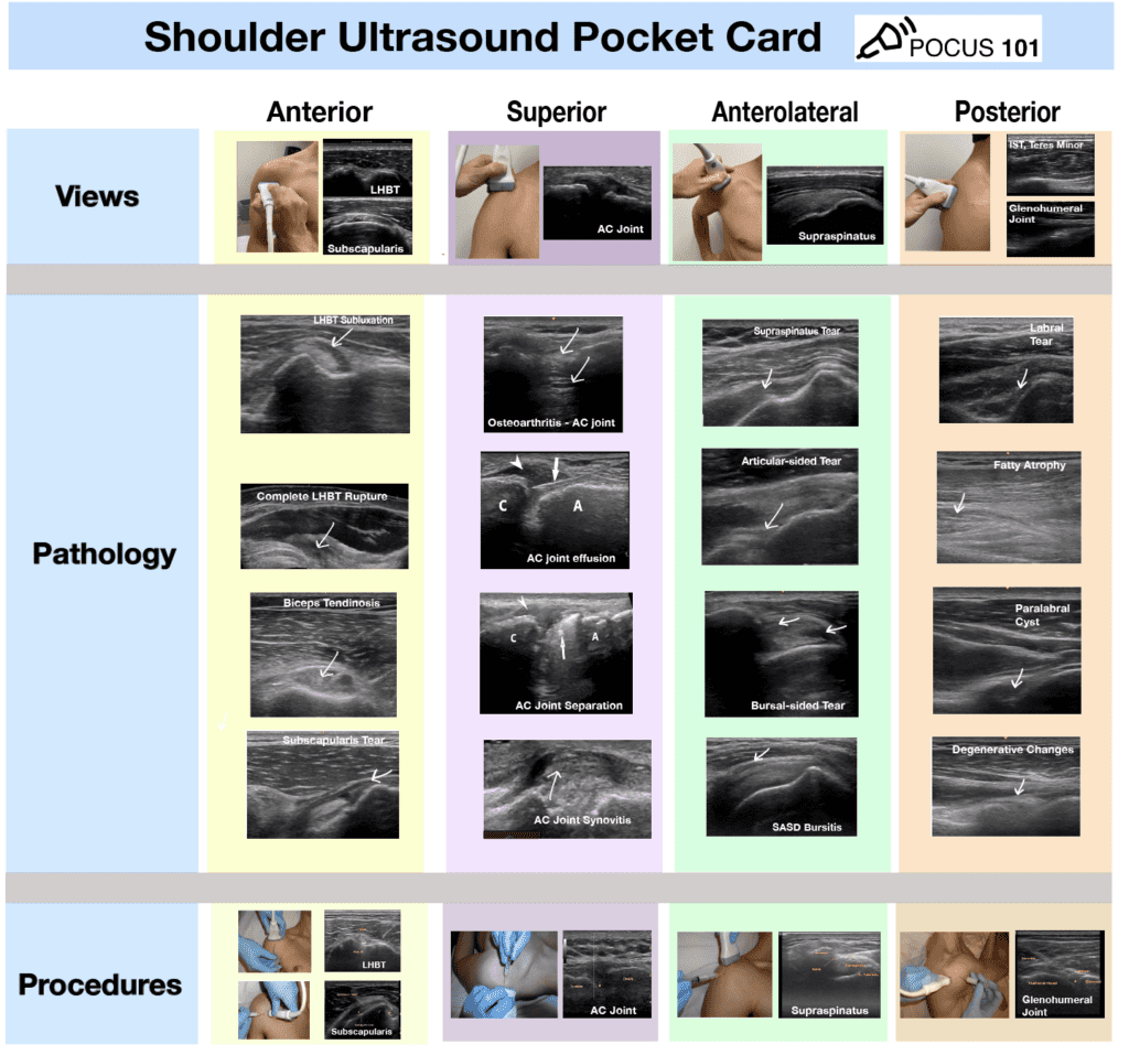 POCUS 101 (@Pocus101) / Posts / X