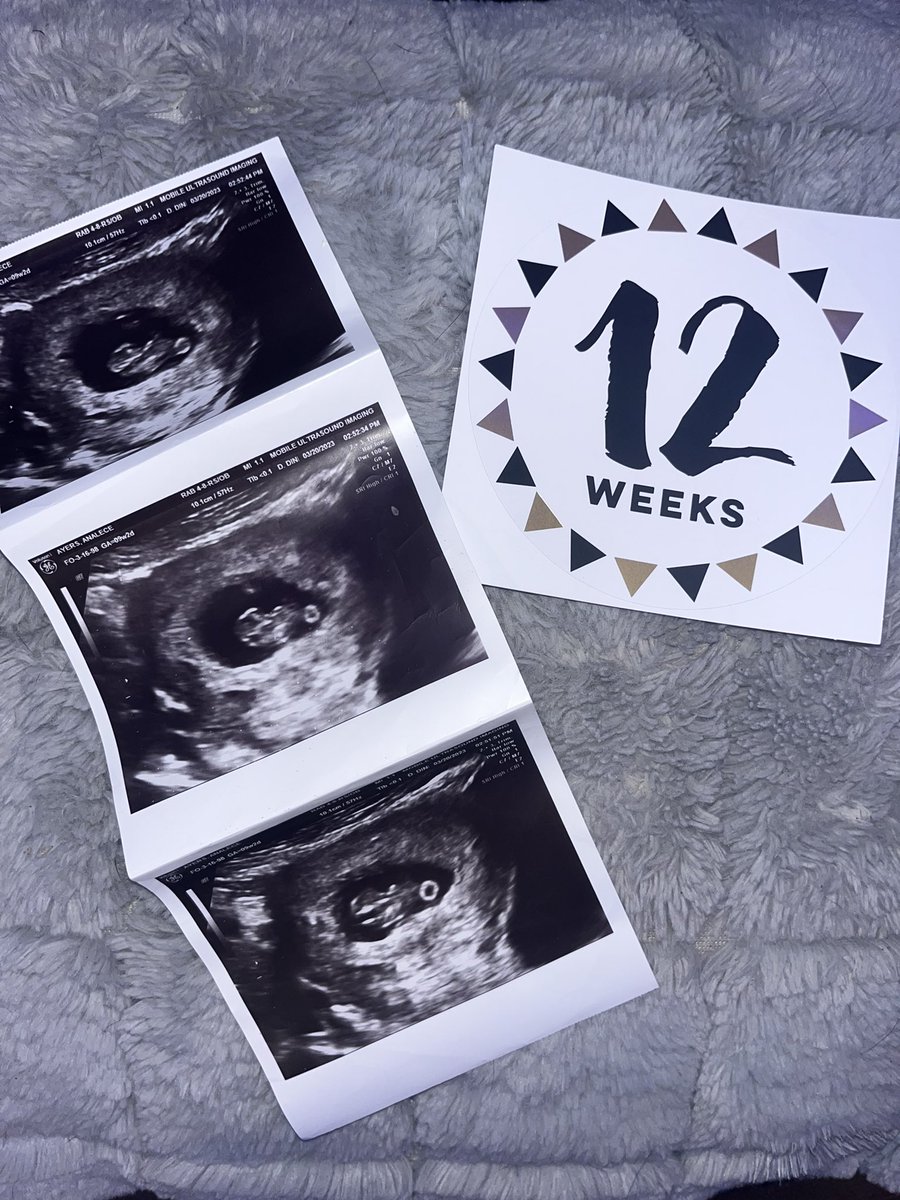 New upcoming release October 21 <a href="/AyersAnalece/">Analece🦢</a>