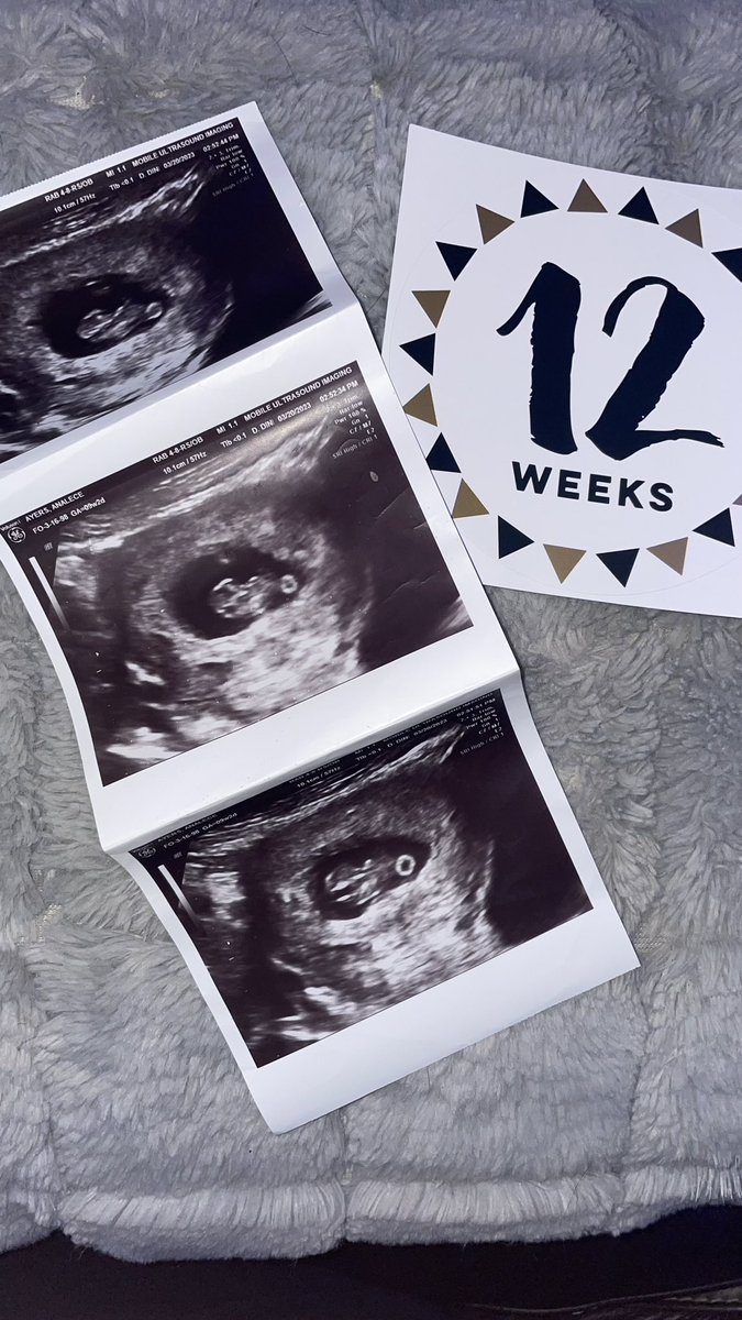 Can’t wait to meet our little pumpkin October 2023 💙🎃