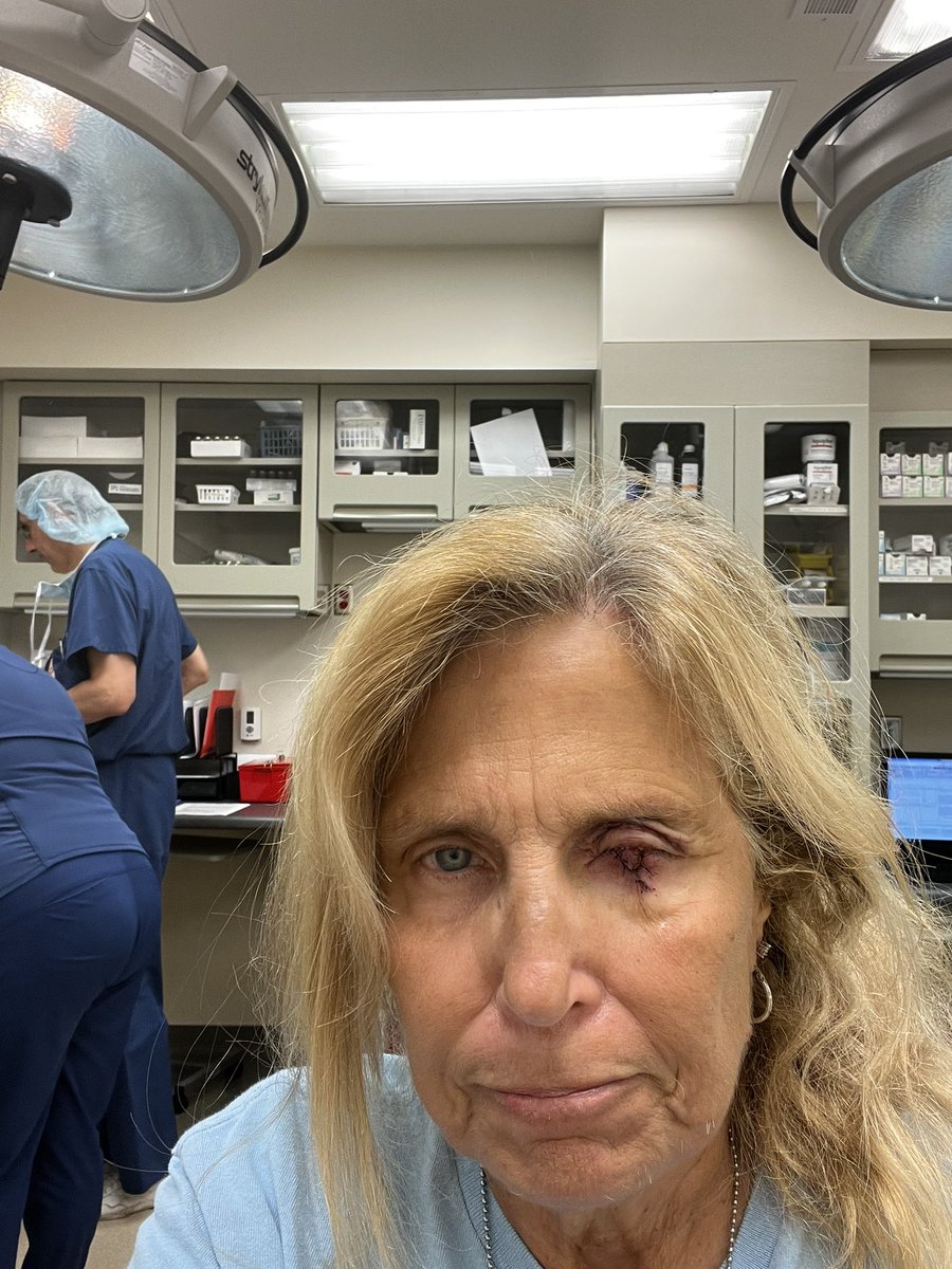 Silenced Survivor 🐭🐴 Vax Injured on Twitter "Me before Vax and after 1