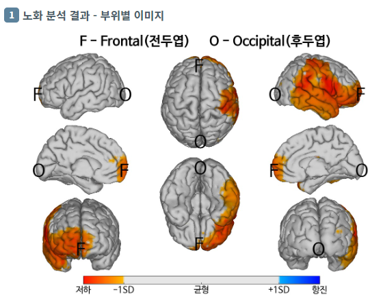 iMedisync's tweet photo. 노화 분석 결과 이미지
Aging Analysis Results Image.
#Aging #analysis #Brainwave #Brainscan #Brainscientist #Brainnavigation #Professor #SeoulNationalUniversity
#iSyncWave #iSyncBrain #Neuroscience #뇌파분석 #경도인지장애 #치매진단 #Therapy #QEEG #EEG #AI알고리즘
#아이메디신 https://t.co/NjkdFEJmlL