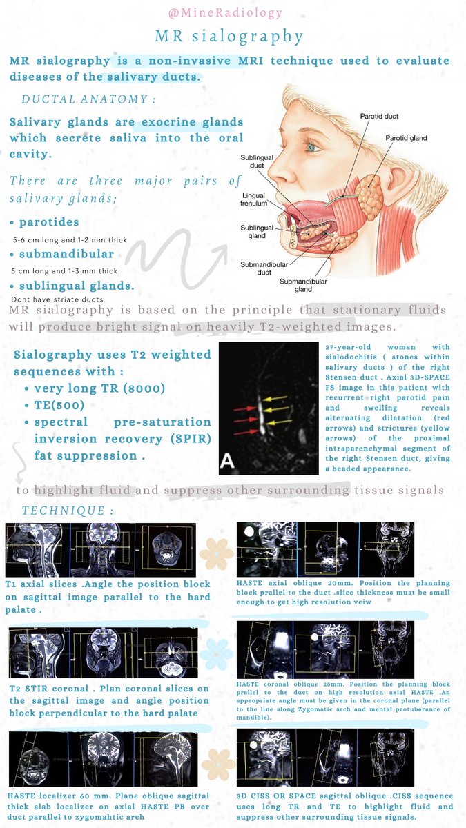 MineRadiology's tweet photo. MRI Sialography🤽🏻‍♀️💡
#MRI #Salivary_gland #Parotid #Submandibular #Sunlingual #Radiology #Radiographer #Imaging #Diagnosis #Sequence #Radiologist #Sialodochitis https://t.co/f7IwYYiCt6