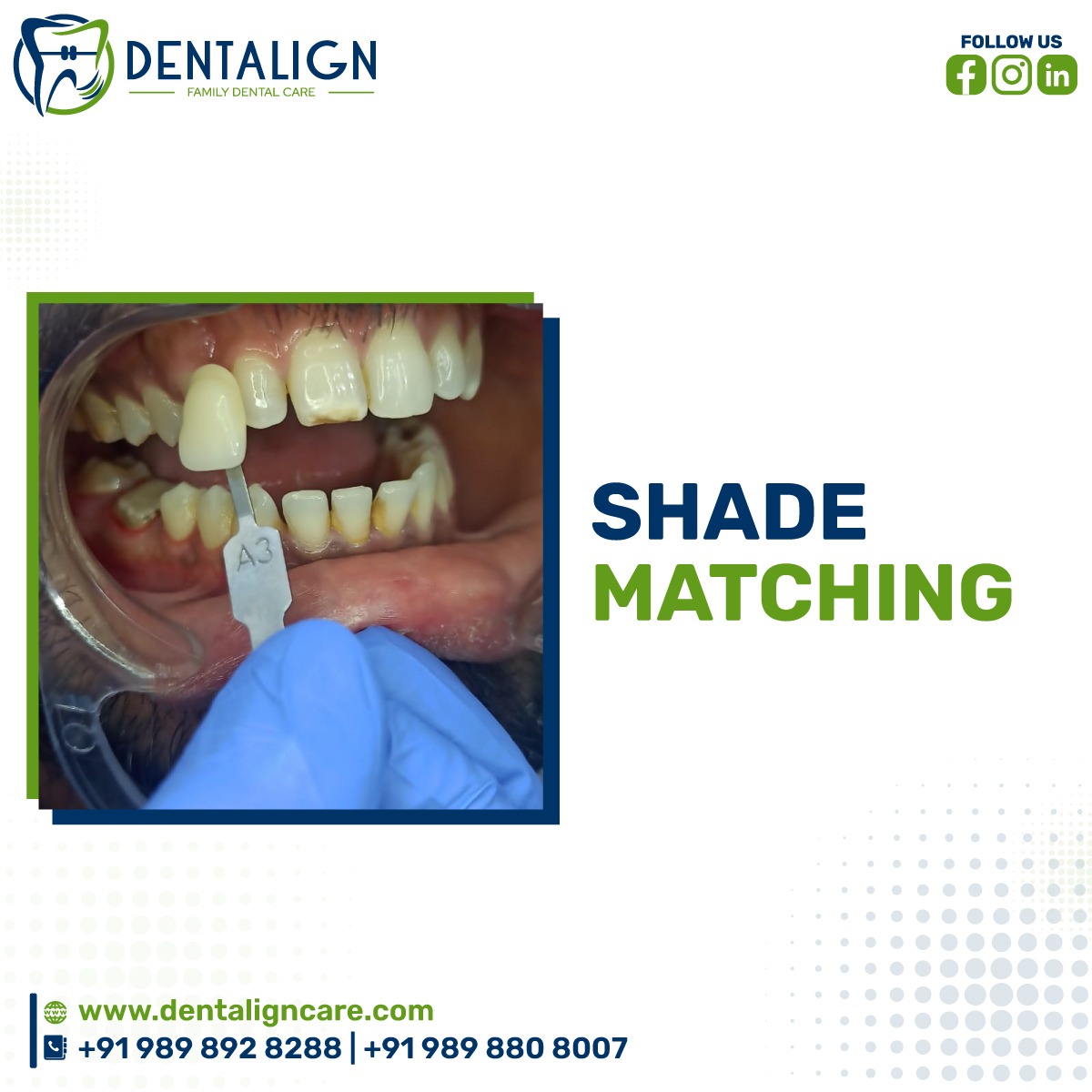 DentalignCare's tweet photo. "Get a brighter, whiter smile with precision dental shade matching"
Get your perfect smile with dentalign care! Get ready to show off that beautiful smile - dentalign care has got you covered!
#dentalign #dentaligncare #smile #shadematching #teeth #dentista #odontologia #dental https://t.co/R0tjRB5ZjD