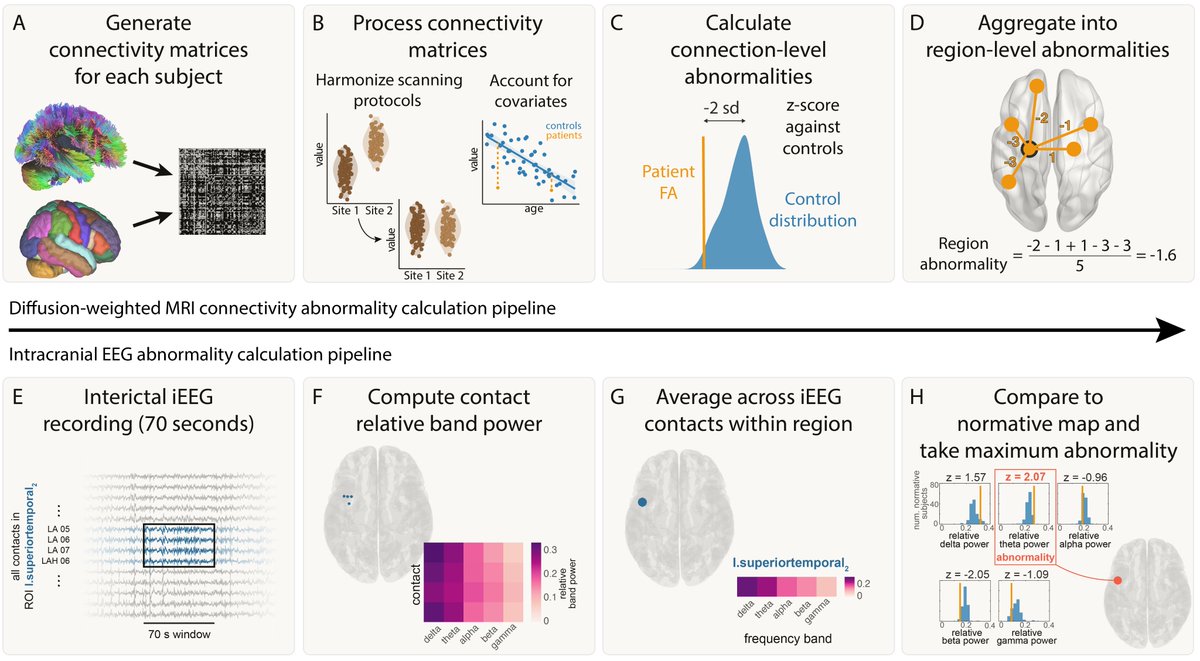 peternealtaylor's tweet photo. New preprint: Complementary structural and functional abnormalities to localise epileptogenic tissue
https://t.co/TrC1ijfQaa https://t.co/oPp02dmUe9