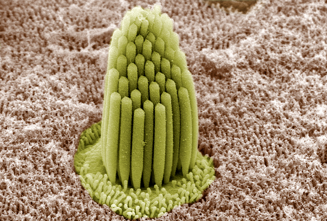 schowardjd's tweet photo. @OGdukeneurosurg SEM image of #stereocilia bundle of a hair cell in the inner ear. https://t.co/8UiBeADAZA