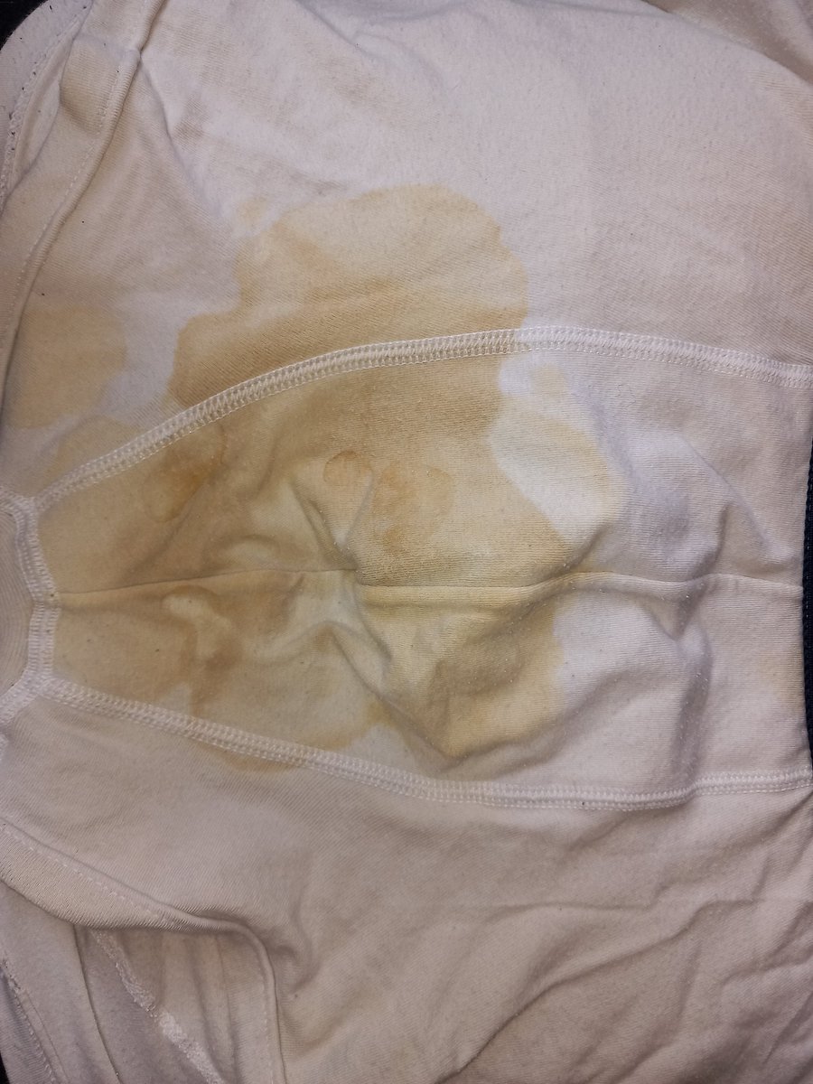 Backup🇩🇪 tweet media