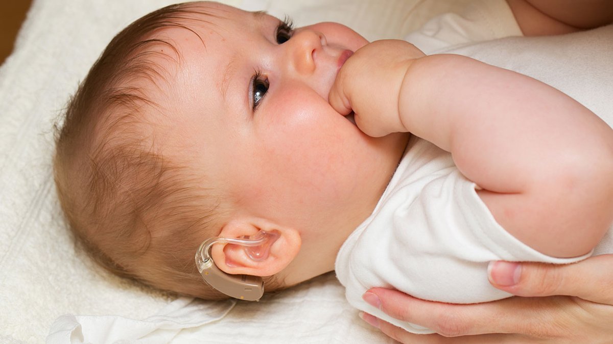 Hearing impairment in newborns most commonly results from cytomegalovirus infection or genetic defects and in older children results from ear infections or earwax.
Visit us: lnkd.in/dAsU9Xp7
#pediatrics #hearingimpairment #pediatricresearch #submission #OpenAccess